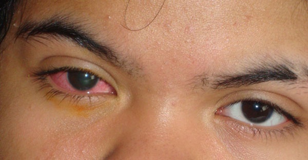 صدى البلد حكم لبس العدسات اللاصقة للرجال والنساء المفتي السابق يجيب