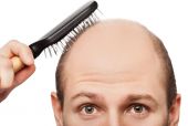 تساقط الشعر عند الرجال أسبابه والحلول