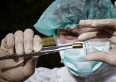 لم تعجبه نتيجة عملية التجميل .. فقتل الطبيب