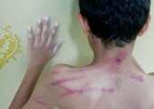السعودية: النقل والحسم والتحويل إلى «إداري» عقوبات معلم ضرب طالباً بأنبوب بلاستيكي   