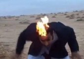 شاب يحرق شعره مازحا فيعرض حياته للخطر