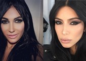 بالصور... أشهر 10 عمليات تجميل للتشبه بالمشاهير