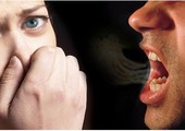 تقرير يكشف 6 أسباب لرائحة الفم الكريهة