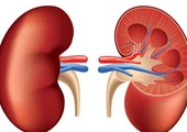 أوبئة أمراض الكلى لها صلة بزيادة موجات الحرارة