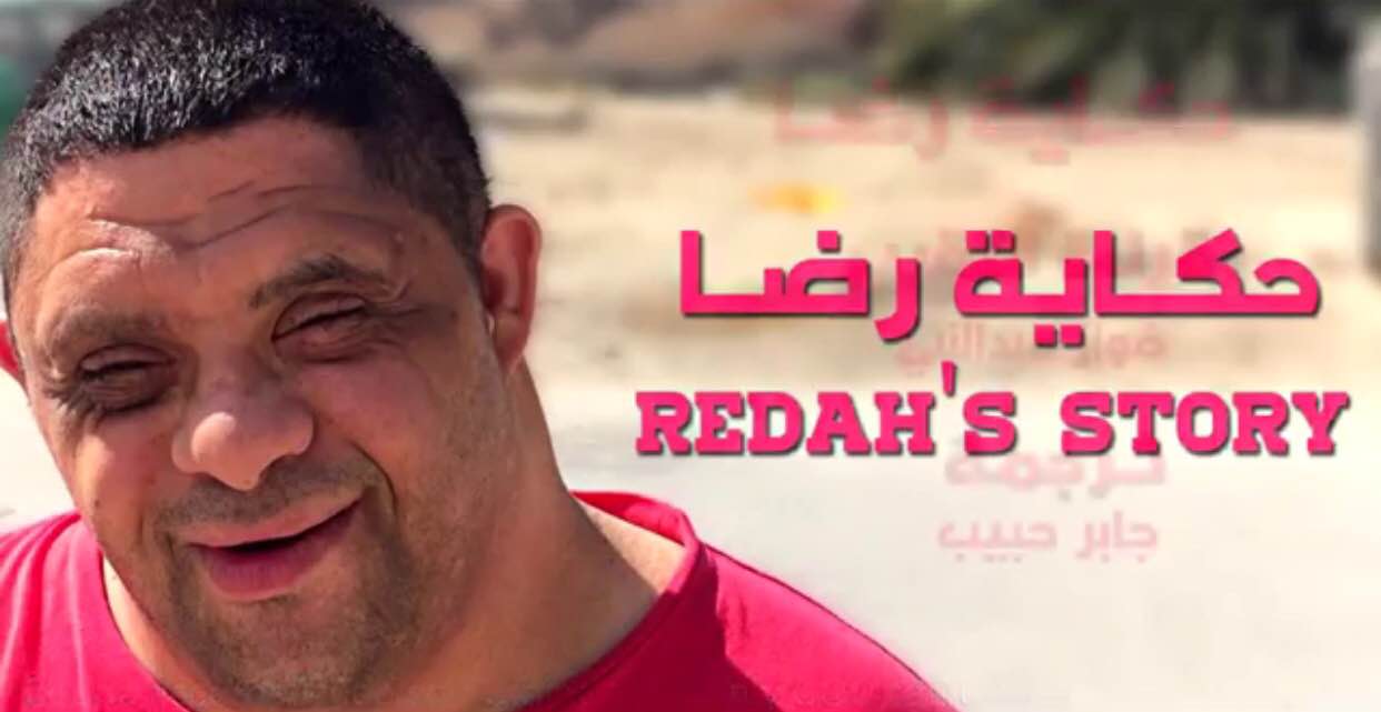 الصورة المغلوطة للمصابين بمتلازمة داون تحتاج إلى تصحيح صحيفة العرب