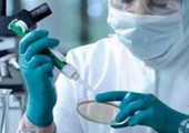 دراسة: مريض واحد نقل العدوى إلى 82 شخصا خلال تفشي فيروس 