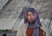 ما هي حكايات جراحات التجميل في المغرب؟
